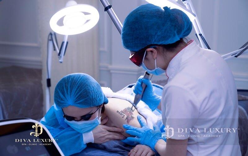 Xóa xăm uy tín tại Tây Ninh